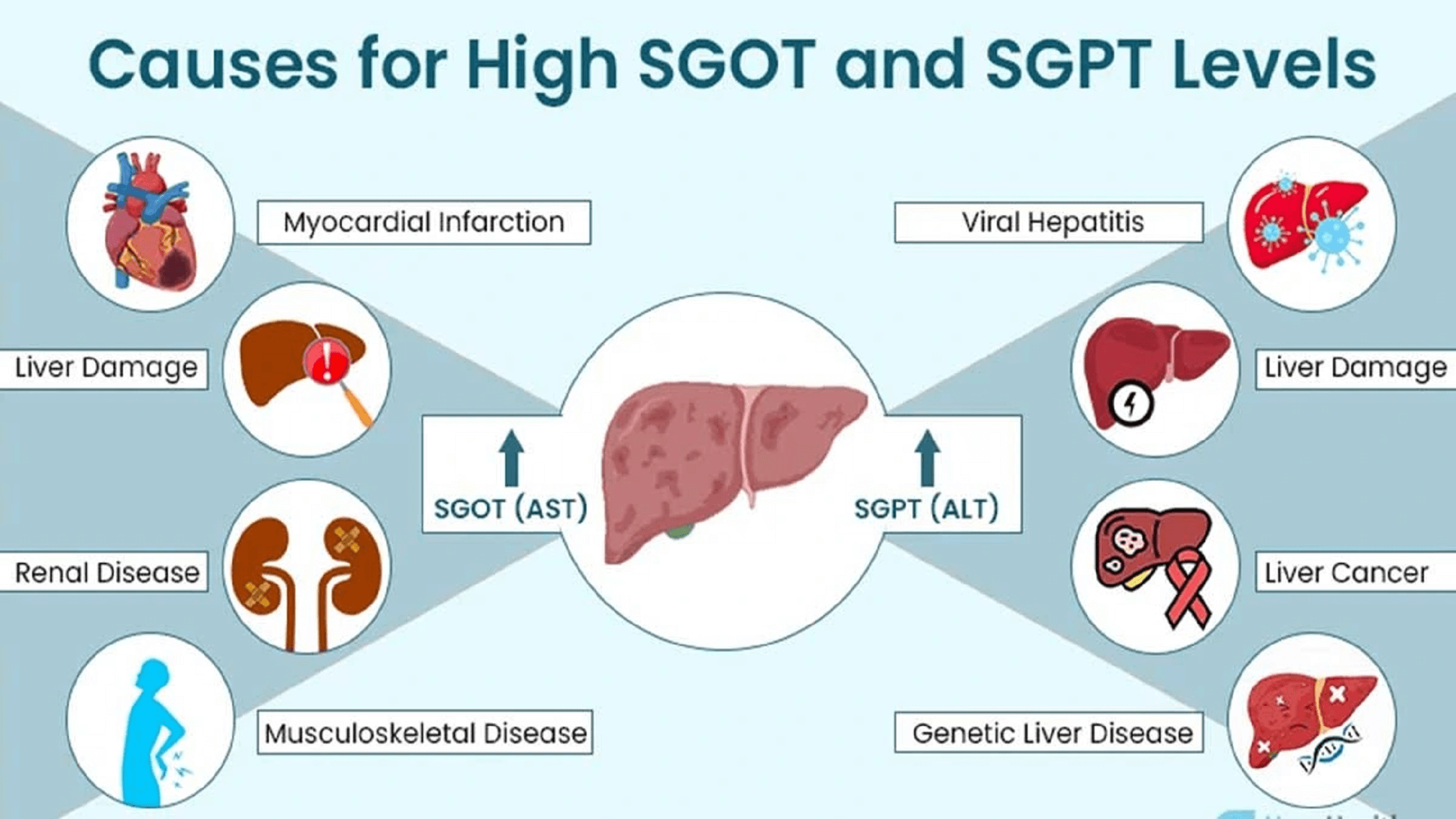 High SGOT & SGPT: Causes, Diagnosis & Treatment