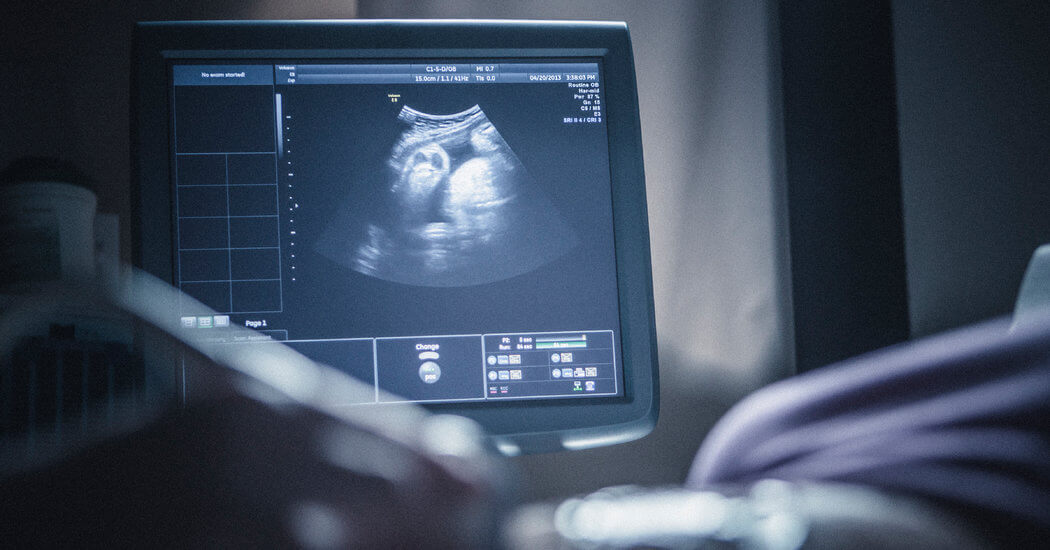 Ultrasound