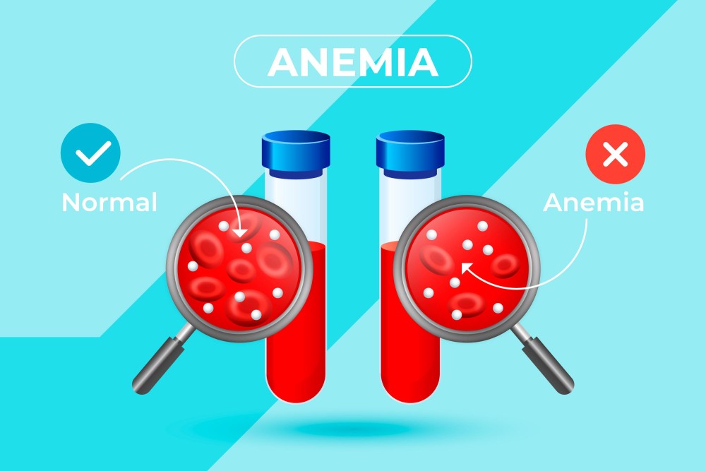 Anemia Testing